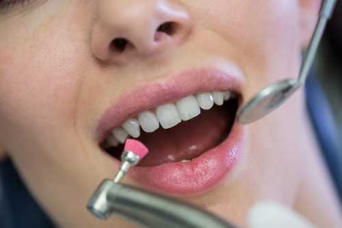 影響補牙的價格因素有哪些