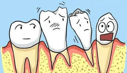 各類型牙折的X光片