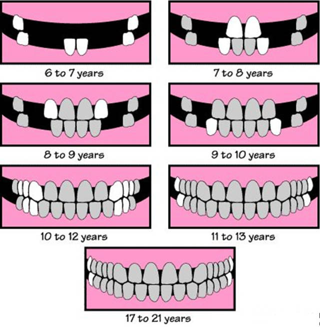 小朋友換牙嘅時候會有雙層牙，想問下幾時先會做窩溝封閉，麻麻應該點樣做？