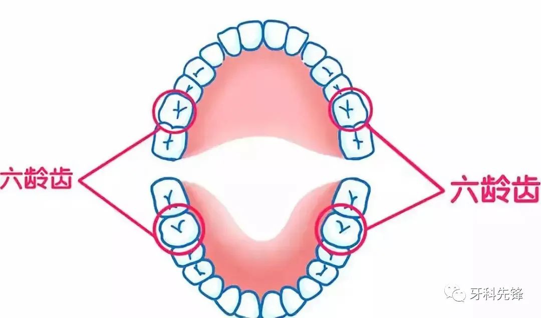 保護“六歲牙” 謹記呢三招