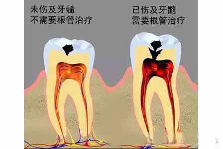 忽視牙齒上嘅哩條“黑線”,好快你就會滿牙黑線！