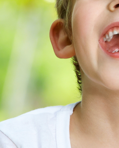 關於牙齒矯正嘅誤區，你知道邊啲？