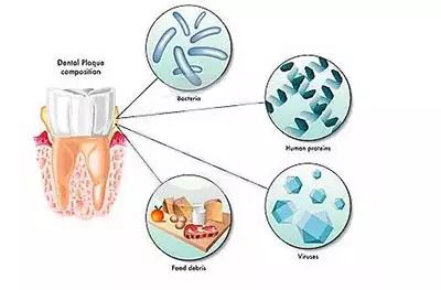 牙菌斑一般係點樣形成嘅