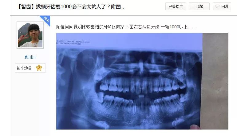 剝兩隻牙收1800人仔？我係唔係被醫生做水魚？