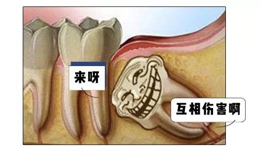 拔咗智齒真係可以瘦臉嗎？