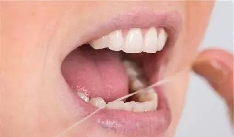 牙齒長出“臭石頭”，聞一下差點嘔咗，牙醫傳授1招，污糟牙垢自己甩落來！