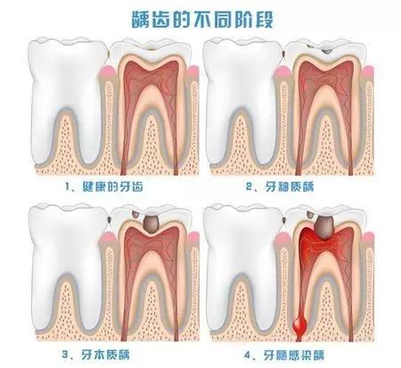 爲什麼口臭，原因可能係哩幾個方面