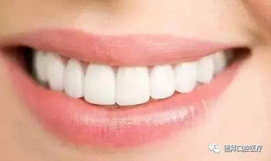 牙齒表面有裂紋該怎麼辦