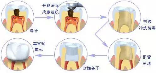 一般人我唔話佢知點樣睇牙最慳錢！