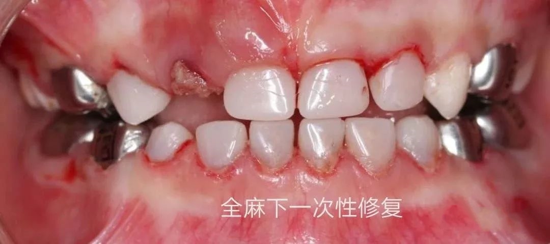 fa3e62f5cced03
