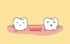 缺牙后最容易陷入的3個誤區，你是不是全中了？