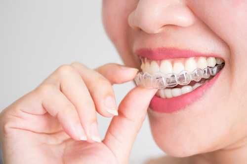 正確使用牙簽去除牙鄰面菌斑，改善食物嵌塞